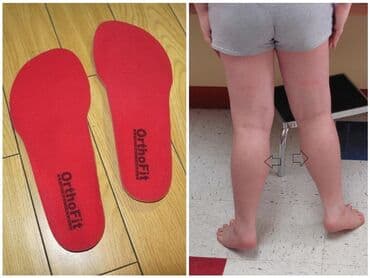 купить ортопедический наколенник: Стельки ортопедические(специализированные) от плоскостопия Для — 5