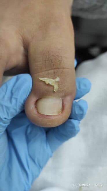 медсестра на дом бишкек мкр: Выравнивание, Наращивание ногтей, Донаращивание ногтей, Маникюр, Педикюр, Услуги подолога, С выездом на дом, Консультация, Одноразовые расходные материалы — 7