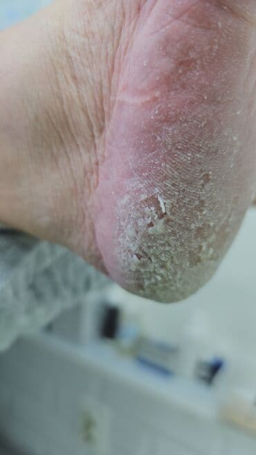 сколько стоит обучение на мастера маникюра: Коррекция вросших ногтей, Маникюр, Педикюр, Услуги подолога, Консультация, Одноразовые расходные материалы — 10