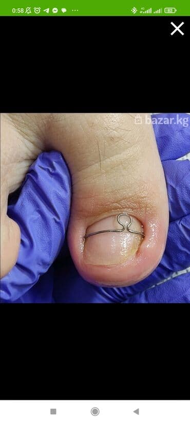 самый лучший эндокринолог рядом просп жибек жолу бишкек: Дизайн, Наращивание ногтей, Гель лак, шеллак, Маникюр, Педикюр, Услуги подолога, Консультация, Одноразовые расходные материалы — 6