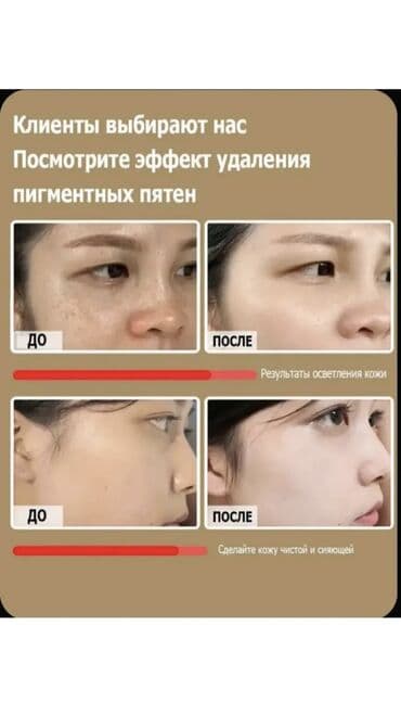 крем для отбеливания кожи и устранения пигментных пятен: JUWAY 377 — отбеливающая эссенция против пигментации и акне в ампулах — 6