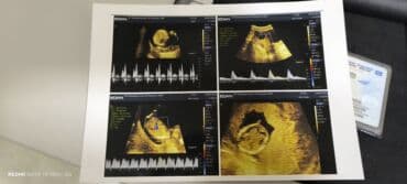 Пульсоксиметры: Ультразвуковая диагностическая аппарат 2024 года выпуска - — 5