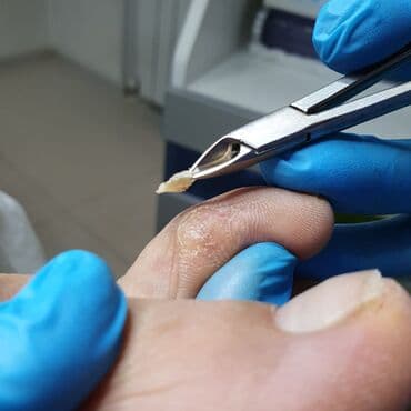 сколько стоит обучение на мастера маникюра: Коррекция вросших ногтей, Маникюр, Педикюр, Услуги подолога, Консультация — 17