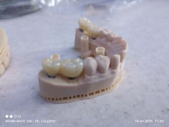 хиджама кровопускание: Клиника | Стоматолог | Протезирование — 23