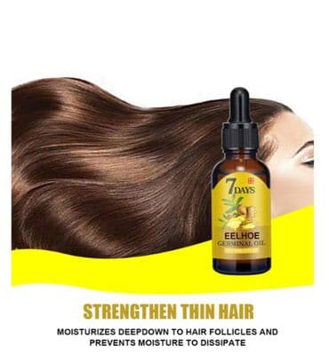 Киреге берилүүчү кийимдер: ❄️ От облысения - имбирь выпадения волос быстрое восстановление — 3