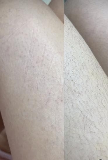 one plus 5: МАНИКЮР +ШУГАРИНГ ТОЛЬКО ДЛЯ ЖЕНЩИН - МАНИКЮР/ПЕЛИКЮР /ШУГАРИНГ — 3