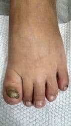 на дом керек: Услуги подолога, С выездом на дом, Консультация, Одноразовые расходные материалы — 13