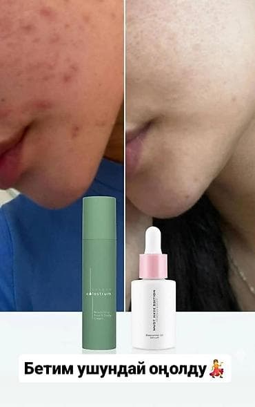 от акне: Essens Colostrum Nourishing Face & Body Cream - Питательный крем — 2