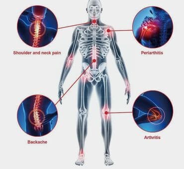 аргон для суставов цена в ташкенте: 🔥 США Разогревающее Средство от Боли в Суставах и Мышцах облегчает — 11