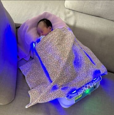 гель для узи: Фотолампа для новорожденных предназначена для лечения желтухи у — 2