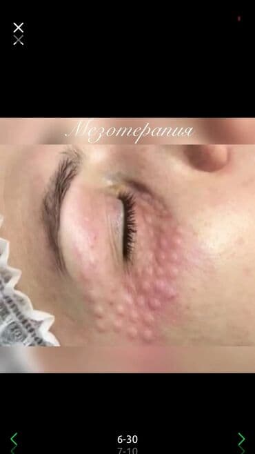 сапоги зимние женские натуральная кожа натуральный мех распродажа: Косметология, Ботокс, Биоревитализация, Ботулинотерапия, Консультация, Гипоаллергенные материалы, Сертифицированный косметолог — 3