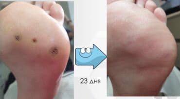 арендовать дом: Выравнивание, Услуги подолога, С выездом на дом, Консультация, Одноразовые расходные материалы — 14