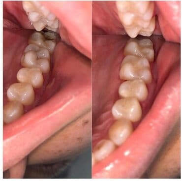 4 роддом бишкек цены: Врачи | Стоматолог | Протезирование — 6