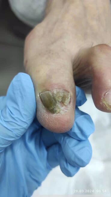 сколько стоит обучение на мастера маникюра: Выравнивание, Наращивание ногтей, Донаращивание ногтей, Маникюр, Педикюр, Услуги подолога, Консультация, Одноразовые расходные материалы — 5