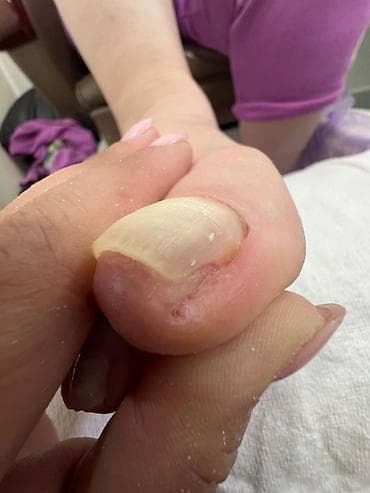 🦶 ПОДОЛОГ — ЭТО НЕ ПРОСТО ПЕДИКЮР. ЭТО ЗДОРОВЬЕ И КОМФОРТ ВАШИХ НОГ ✨ — 3
