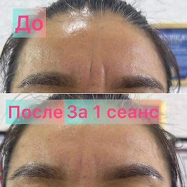 крем антицеллюлитный: Массаж | Консультация — 2