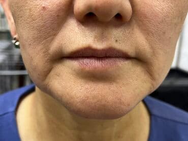 самый лучший эндокринолог рядом просп жибек жолу бишкек: Косметология, Маски, Мезотерапия, Удаление носогубных складок, Гипоаллергенные материалы, Консультация, Сертифицированный косметолог — 9