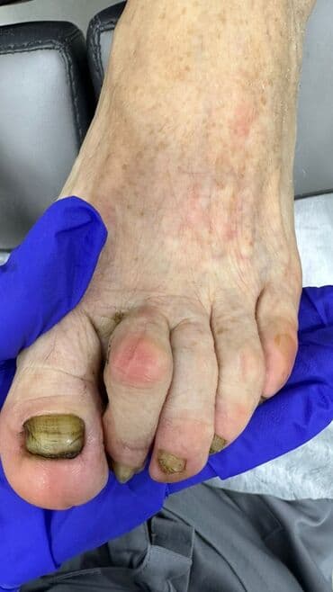 сколько стоит обучение на мастера маникюра: Коррекция вросших ногтей, Маникюр, Педикюр, Услуги подолога, Консультация, Одноразовые расходные материалы — 2