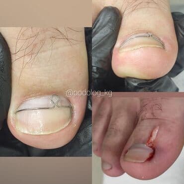 сколько стоит обучение на мастера маникюра: Коррекция вросших ногтей, Маникюр, Педикюр, Услуги подолога, Консультация, Одноразовые расходные материалы — 7