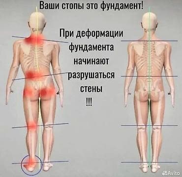 Медтовары: Ортопедические стельки Health Priority с анионами - Профессиональные — 5
