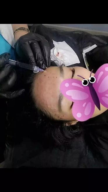 лечебные массаж ош: Лазерная эпиляция. Чистка лица. Лечение акне. Гименопластика — 5