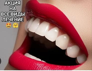 установка поровой: Клиника | Стоматолог | Диагностика — 1