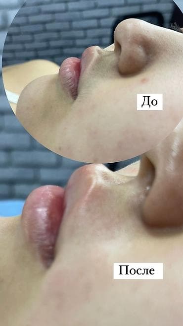 SPA-салон | Пилинг — 5