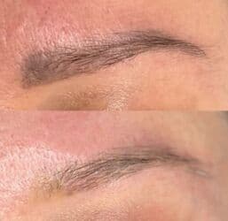 визажное кресло: Продаю лазерный аппарат для удаления татуажа, перманента, татуировок — 3