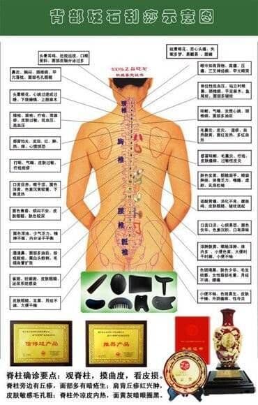 магнитные браслеты от давления: БЯНЬШИ! Бянши – это редчайшая разновидность полудрагоценного камня — 2