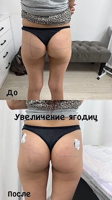 ава терапия: Коллагенотерапия и уход с экзосомами, пептидами и 8 видами коллагена — 6
