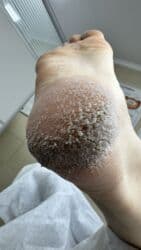 на дом керек: Услуги подолога, С выездом на дом, Консультация, Одноразовые расходные материалы — 15