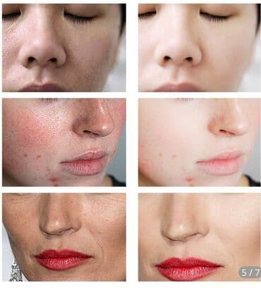 h2 premium магний водород инструкция: Эффект замедленного высвобождения гиалуроновой кислоты позволяет — 2