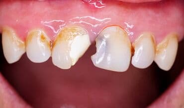 лучший детский стоматолог бишкек: Стоматолог Бишкек. Профессиональная чистка. Лечение кариеса и его — 9