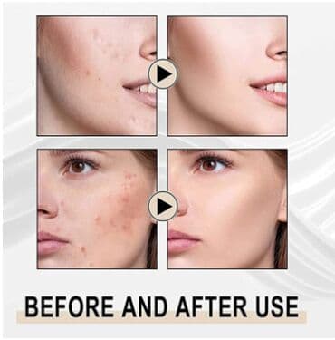 шампунь дисаар: ❄️ сша амазон отбеливающий гель для глубокого пилинга skill papaya — 11