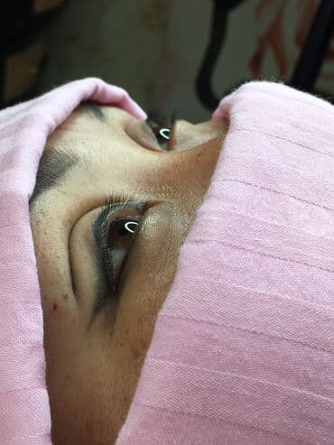 сангапури: Косметология, Маски, Биоревитализация, Ботокс, С выездом на дом, Консультация, Гипоаллергенные материалы — 3