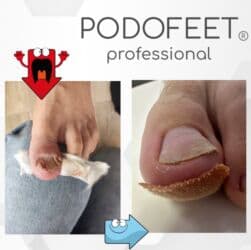 арендовать дом: Выравнивание, Услуги подолога, С выездом на дом, Консультация, Одноразовые расходные материалы — 11