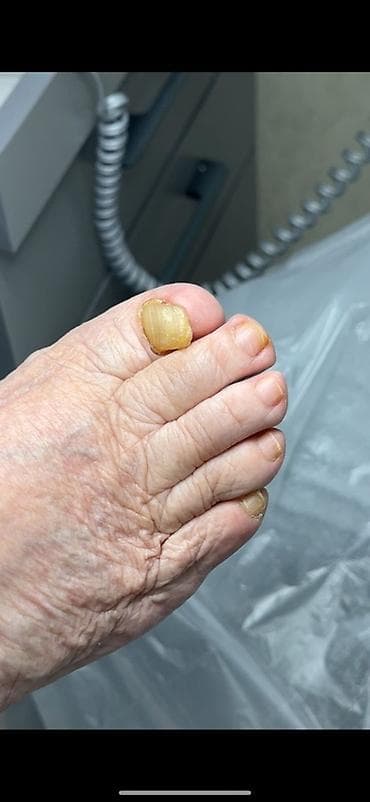 подолог в бишкеке: Подологические услуги: лечение проблем ногтей и стоп Подолог, Бишкек — 2