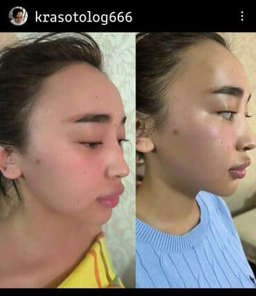 медицинский массаж курсы: Косметология, Разглаживание и коррекция морщин, Моделирование лица, Лифтинг, Гипоаллергенные материалы — 12