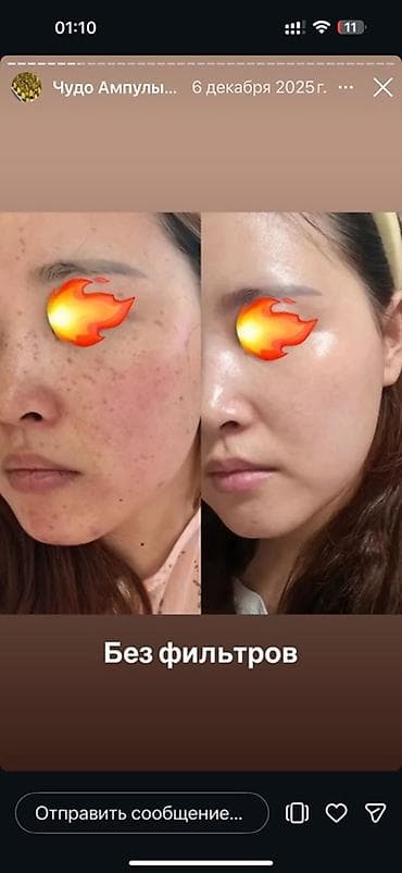 nike original: Ампулы для лица SymWhite 377 Ampoule (JUWAY) — осветляющая и — 9