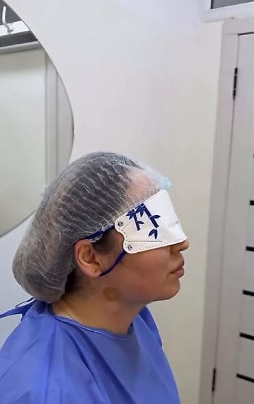 лицо: Липосакция второго подбородка и брыли по Акции вместо 35000с со — 3