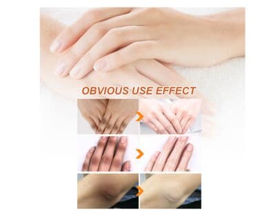 личный кабинет эрсаг кыргызстан: ❄️ США Отбеливать кожу - Масло семян папайи Осветлитель для кожи — 3