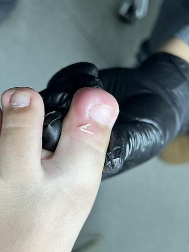 бесплатный маникюр в бишкеке: Маникюр, Педикюр, Услуги подолога, С выездом на дом, Консультация, Одноразовые расходные материалы — 2