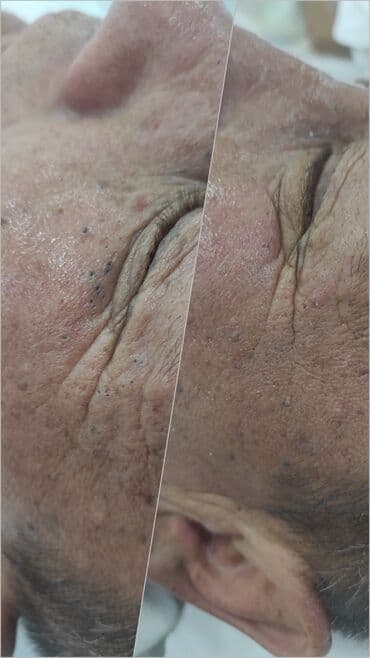 самый лучший эндокринолог рядом просп жибек жолу бишкек: Косметология, Контурное моделирование, Лечение угревой болезни, Маски, Консультация, Гипоаллергенные материалы, Сертифицированный косметолог — 10