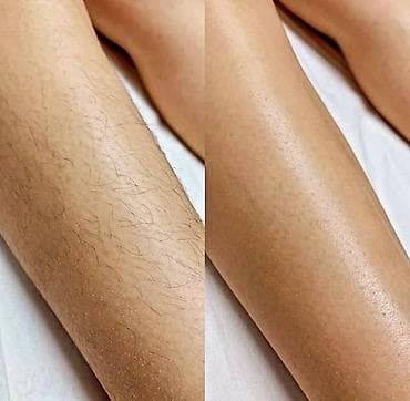 пилинг для мужчин: Восковая депиляция для женщин и мужчин Подмышки - 500 сом — 10