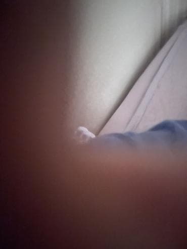 рещетка для окон: Окно: Ремонт — 3