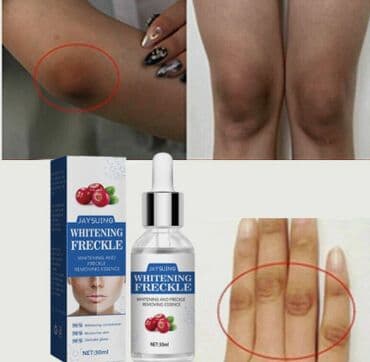 корейские бады день и ночь отзывы: ❄️ США Сыворотка отбеливающая от веснушек и пигментных пятен а так же — 4