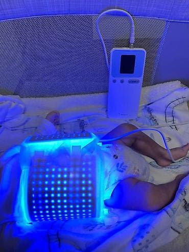 софт боксы: Фотолампа от желтушки для лечения желтушки. Светодиодная фотолампа в — 4
