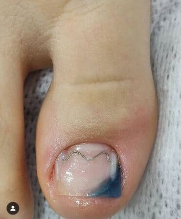 сколько стоит обучение на мастера маникюра: Выравнивание, Наращивание ногтей, Донаращивание ногтей, Маникюр, Педикюр, Услуги подолога, Консультация — 7