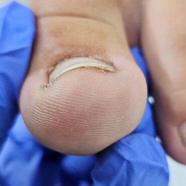 самый лучший эндокринолог рядом просп жибек жолу бишкек: Коррекция вросших ногтей, Услуги подолога, Маникюр, Педикюр, Одноразовые расходные материалы, Консультация — 4