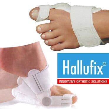 фиксатор для ног: Ортопедическая шина HALLUFIX Адрес: Лермонтова — 2